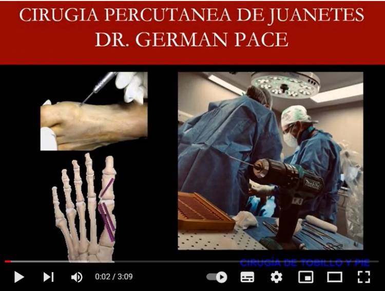 Dr German Pace , Medico especialista en pie Pilar